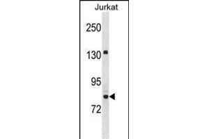 UHRF2 Antibody (Center) (ABIN1538450 and ABIN2850120) western blot analysis in Jurkat cell line lysates (35 μg/lane). (UHRF2 antibody  (AA 479-508))