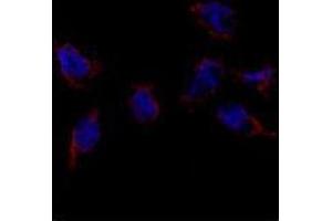 Immunofluorescence analysis of Bmp7 Antibody in HeLa cells.