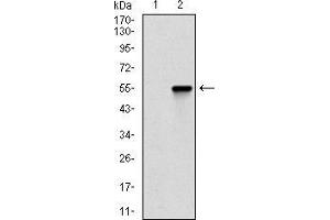 Western blot analysis using CTNNBL1 mAb against HEK293 (1) and CTNNBL1 (AA: 390-557)-hIgGFc transfected HEK293 (2) cell lysate. (CTNNBL1 antibody  (AA 390-557))