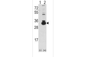 Western blot analysis of KHK using rabbit polyclonal Ketohexokinase (KHK) Antibody using 293 cell lysates (2 ug/lane) either nontransfected (Lane 1) or transiently transfected with the KHK gene (Lane 2).