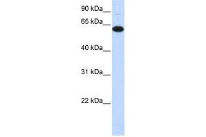 WB Suggested Anti-FBXO24 Antibody Titration:  0. (FBXO24 antibody  (Middle Region))