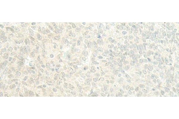 ESRP2 antibody