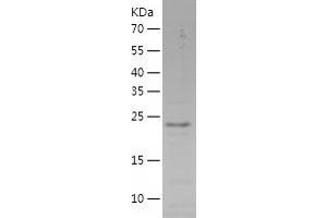 SSX5 Protein (AA 1-188) (His tag)