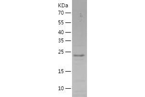 Western Blotting (WB) image for Synovial Sarcoma, X Breakpoint 5 (SSX5) (AA 1-188) protein (His tag) (ABIN7283238) (SSX5 Protein (AA 1-188) (His tag))