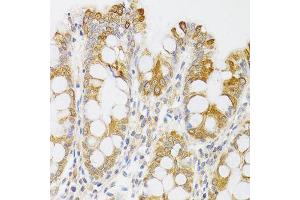 Immunohistochemistry of paraffin-embedded human rectum using MYO5A antibody (ABIN6003562) at dilution of 1/100 (40x lens). (MYO5A antibody)