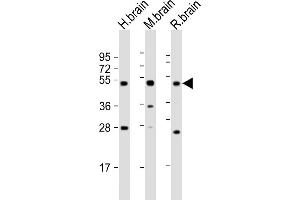 All lanes : Anti-NPTX1 Antibody at 1:2000 dilution Lane 1: human brain lysate Lane 2: mouse brain lysate Lane 3: rat brain lysate Lysates/proteins at 20 μg per lane. (NPX1 antibody  (AA 322-350))