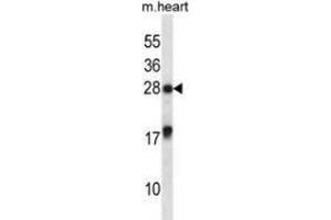 Western blot analysis in mouse heart tissue lysates (35ug/lane) using MXI1 Antibody . (MXI1 antibody  (Middle Region))