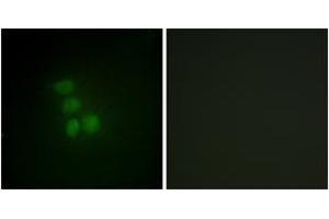 Immunofluorescence analysis of HepG2 cells, using hnRNP G Antibody.