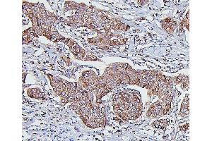 IHC analysis of HSPD1 using anti-HSPD1 antibody (ABIN7600976). (HSPD1 antibody  (AA 260-496))