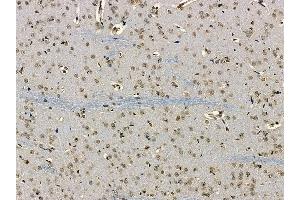 CCDC98 Antibody at 1/100 staining rat brain tissue by IHC-P.