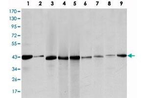 Western blot analysis using ACTA2 monoclonal antibody, clone 1H8  against HeLa (1), Jurkta (2), HepG2 (3), MCF-7 (4), A-431 (5), A-549 (6), PC-12 (7), NIH/3T3 (8) and COS-7 (9) cell lysate.