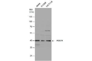WB Image PSAT1 antibody [N1C3] detects PSAT1 protein by western blot analysis. (PSAT1 antibody)