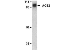 Western blot analysis of ACE2 in human kidney lysate with AP30008PU-N ACE2 antibody at 1 μg/ml. (ACE2 antibody  (N-Term))