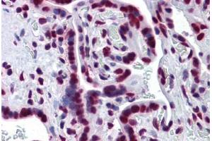 Human Placenta: Formalin-Fixed, Paraffin-Embedded (FFPE) (Splicing Factor 1 antibody  (AA 1-111))