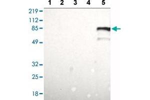 Western blot analysis of Lane 1: RT-4 cell lysate, Lane 2: U-251 MG sp cell lysate, Lane 3: A-431 cell lysate, Lane 4: Human liver tissue, Lane 5: Human tonsil tissue with BTK polyclonal antibody  at 1:100 - 1:250 dilution. (BTK antibody  (AA 206-351))