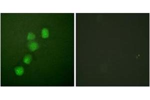 Immunofluorescence analysis of HuvEc cells, using Cyclin E1 (Ab-395) Antibody. (Cyclin E1 antibody  (AA 361-410))