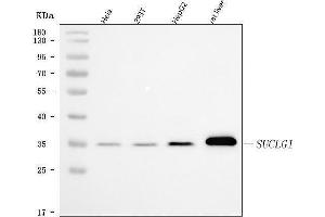 Western blot analysis of SUCLG1 using anti-SUCLG1 antibody (ABIN7600906).