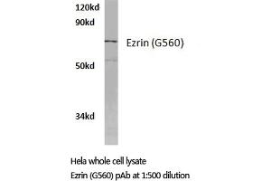 Western blot (WB) analyzes of Ezrin antibody in extracts from HELA cells. (Ezrin antibody)