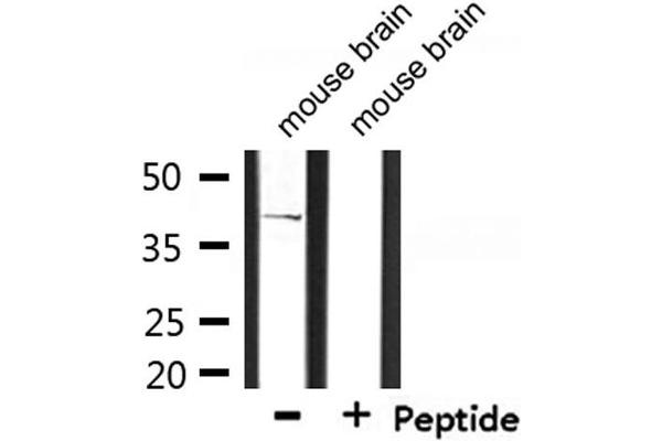 CD2BP2 antibody  (Internal Region)