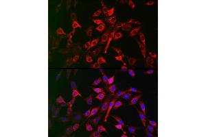 Immunofluorescence analysis of NIH/3T3 cells using LRP5 Rabbit pAb (ABIN1513164, ABIN3020644, ABIN3020646 and ABIN6213630) at dilution of 1:200 (40x lens).