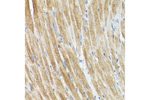 Immunohistochemistry of paraffin-embedded rat heart using DRP1 Rabbit pAb (ABIN3023669, ABIN3023670, ABIN3023671, ABIN1679564 and ABIN6219696) at dilution of 1:250 (40x lens). (Dynamin 1-Like antibody  (AA 411-710))