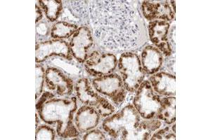 Immunohistochemical staining of human kidney with CNBD1 polyclonal antibody  shows strong cytoplasmic positivity in cells in tubules at 1:200-1:500 dilution. (CNBD1 antibody)