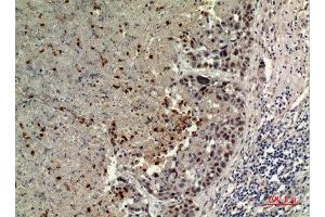 Immunohistochemistry (IHC) analysis of paraffin-embedded Human Lung, antibody was diluted at 1:100. (BCAT1 antibody  (Internal Region))