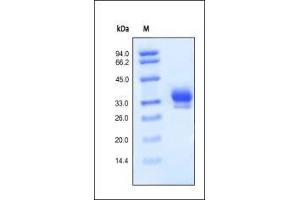 SDS-PAGE (SDS) image for Interleukin 29 (IL29) (AA 20-200) protein (His tag) (ABIN2181309) (IL29 Protein (AA 20-200) (His tag))