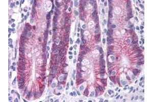 Human Small Intestine: Formalin-Fixed, Paraffin-Embedded (FFPE) (ASAH2 antibody  (C-Term))