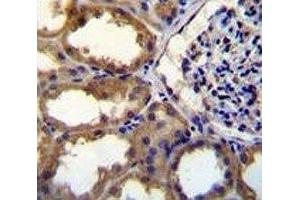 PDGFC antibody immunohistochemistry analysis in formalin fixed and paraffin embedded human kidney tissue. (PDGFC antibody  (AA 74-103))