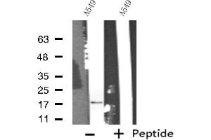 Western blot analysis of extracts from A549 cells, using COX5A antibody. (COX5A antibody  (Internal Region))