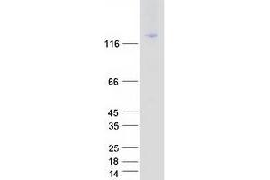 Validation with Western Blot (ITGAL Protein (Transcript Variant 1) (Myc-DYKDDDDK Tag))