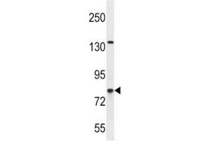 CPT1B antibody western blot analysis in SK-BR-3 lysate (CPT1B antibody  (AA 744-770))