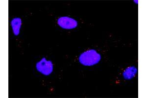 Proximity Ligation Analysis of protein-protein interactions between MAPK11 and MAP3K7IP1. (MAPK11 antibody  (AA 1-364))