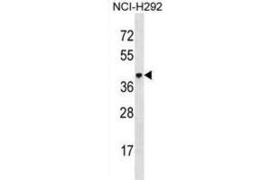 Western Blotting (WB) image for anti-V-Set and Immunoglobulin Domain-Containing Protein 4 (VSIG4) antibody (ABIN3000551) (VSIG4 antibody)