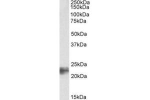 Image no. 1 for anti-Transgelin (TAGLN) (C-Term) antibody (ABIN374407) (Transgelin antibody  (C-Term))