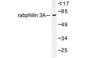 Image no. 1 for anti-Rabphilin 3A (RPH3A) antibody (ABIN272075)