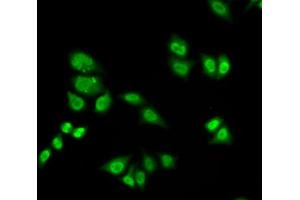 Immunofluorescence analysis of  cells using GTF2F2 antibody (ABIN6131726, ABIN6141494, ABIN6141496 and ABIN6217519). (GTF2F2 antibody  (AA 1-249))