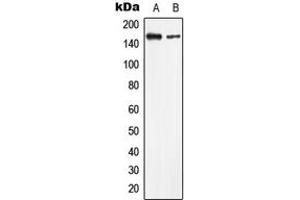 Western blot analysis of LMTK2 expression in HeLa (A), HEK293T (B) whole cell lysates. (LMTK2 antibody  (Center))