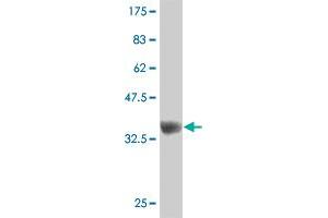 Western Blot detection against Immunogen (37. (ZNF207 antibody  (AA 1-110))