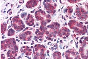 Human Breast: Formalin-Fixed, Paraffin-Embedded (FFPE) (Retinoblastoma Binding Protein 8 antibody  (AA 452-747))