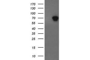Western Blotting (WB) image for anti-ALX Homeobox 4 (ALX4) antibody (ABIN1496621)