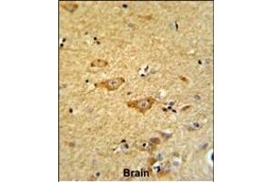 Formalin-fixed and paraffin-embedded human brain reacted with OMD Antibody (Center), which was peroxidase-conjugated to the secondary antibody, followed by DAB staining. (Osteomodulin antibody  (AA 234-263))