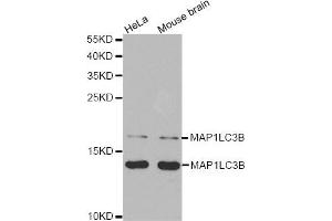 Western Blotting (WB) image for anti-Microtubule-Associated Protein 1 Light Chain 3 beta (MAP1LC3B) antibody (ABIN1876926)