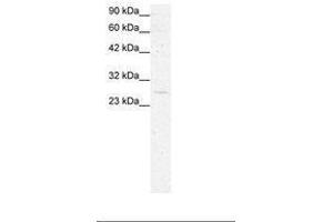 Image no. 3 for anti-YEATS Domain Containing 4 (AA 158-207) antibody (ABIN6735809) (GAS41 antibody  (AA 158-207))