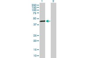 Western Blot analysis of TMEM171 expression in transfected 293T cell line by TMEM171 MaxPab polyclonal antibody. (TMEM171 antibody  (AA 1-323))
