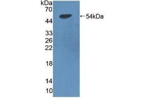 Detection of Recombinant LIPD, Rat using Polyclonal Antibody to Lipoprotein lipase (LPL) (Lipoprotein Lipase antibody  (AA 28-474))