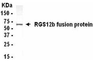 Western Blotting (WB) image for anti-Regulator of G-Protein Signalling 12 (RGS12) (AA 1372-1447) antibody (ABIN2467877) (RGS12 antibody  (AA 1372-1447))