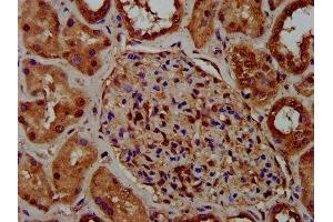 IHC image of ABIN7149368 diluted at 1:400 and staining in paraffin-embedded human kidney tissue performed on a Leica BondTM system. (CKAP5 antibody  (AA 1802-2019))