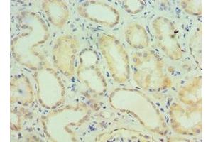 Immunohistochemistry of paraffin-embedded human kidney tissue using ABIN7147272 at dilution of 1:100 (CIDEC antibody  (AA 1-238))